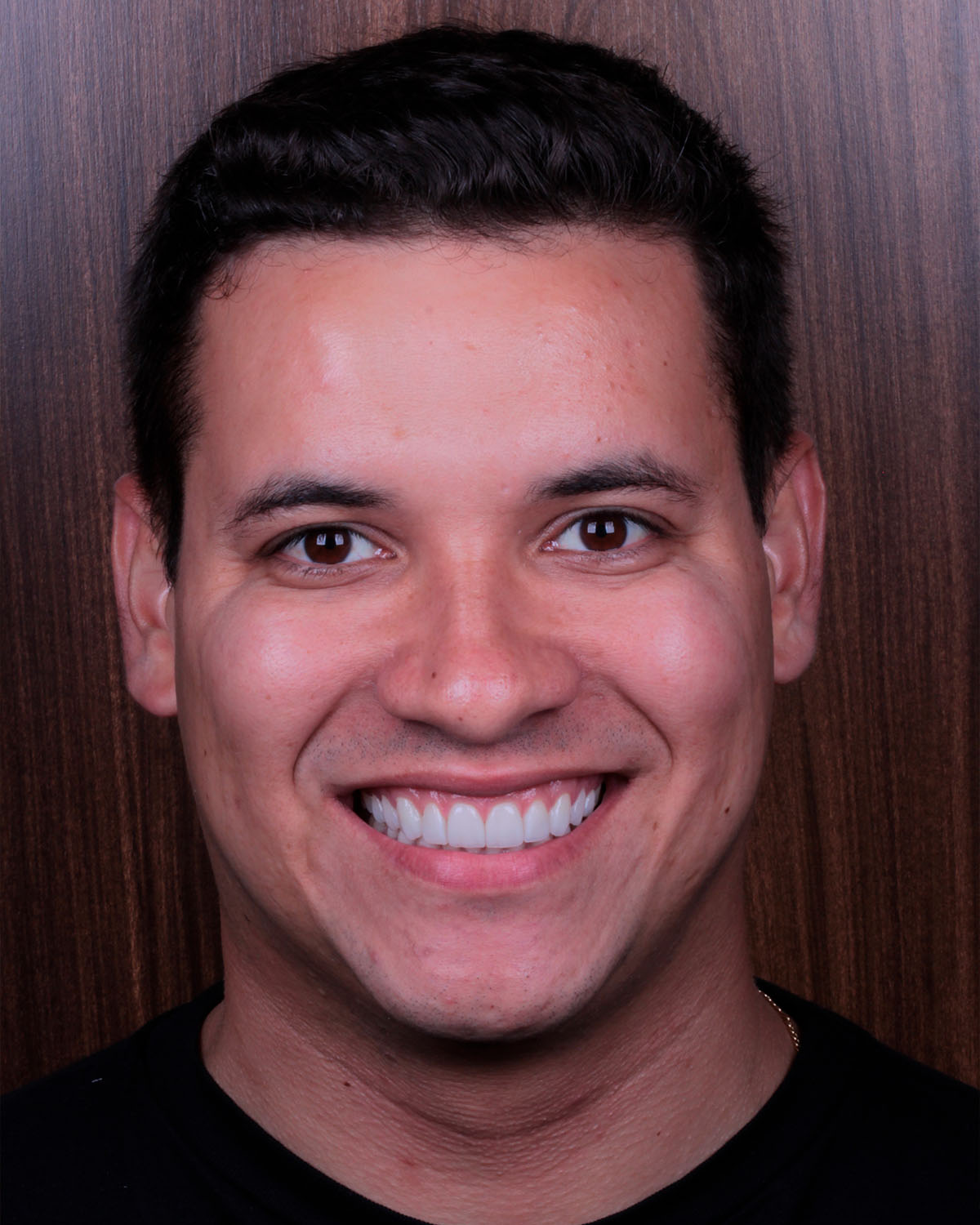 Sorriso natural com Lentes de Porcelana na Oral Person Campo Grande